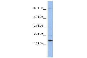 WB Suggested Anti-SNRPD2 Antibody Titration:  0. (SNRPD2 Antikörper  (Middle Region))