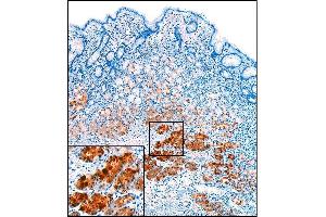 Immunohistochemistry (IHC) image for anti-Pepsinogen A antibody (ABIN108409) (Pepsinogen A Antikörper)