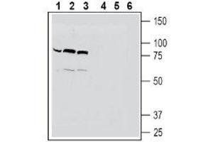 Western blot analysis of human  monocytic leukemia cell line lysates (lanes 1 and 4), mouse  microglia cell line lysates (lanes 2 and 5) and human HeLa cervix adenocarcinoma cell line lysates (lanes 3 and 6):1-3. (Solute Carrier Family 22 Member 4 (SLC22A4) Peptid)