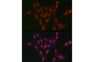 Immunofluorescence (IF) image for anti-Transporter 2, ATP-Binding Cassette, Sub-Family B (MDR/TAP) (TAP2) (AA 430-680) antibody (ABIN3022237)