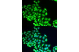 Immunofluorescence analysis of HeLa cells using XPD/XPD/ERCC2 antibody (ABIN6130301, ABIN6140265, ABIN6140266 and ABIN6221277). (ERCC2 Antikörper  (AA 1-300))