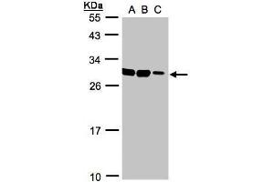 WB Image Sample(30 ug whole cell lysate) A:HeLa S3, B:Hep G2 , C:MOLT4 , 12% SDS PAGE antibody diluted at 1:1000 (ASB9 Antikörper)