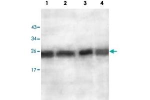 Western blot analysis of ES2 cell (Lane 1), EC109 cell (Lane 2), human fetal lung (Lane 3) and human fetal brain (Lane 4) lysate with AKR1A1 polyclonal antibody  at 1 : 500 dilution. (AKR1A1 Antikörper  (AA 132-310))
