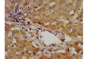 IHC image of ABIN7142878 diluted at 1:400 and staining in paraffin-embedded human liver tissue performed on a Leica BondTM system.