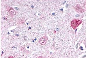 Anti-NR1D1 antibody  ABIN1049129 IHC staining of human brain, thalamus. (NR1D1 Antikörper  (Internal Region))