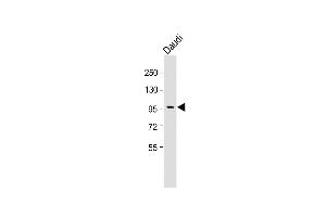 Anti-INB Antibody (C-term) at 1:1000 dilution + Daudi whole cell lysate Lysates/proteins at 20 μg per lane. (INPP5B Antikörper  (C-Term))