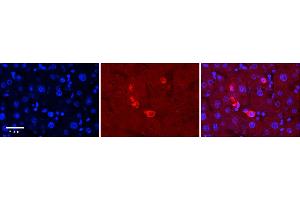 Rabbit Anti-MAPK7 Antibody  Catalog Number: ARP57731_P050 Formalin Fixed Paraffin Embedded Tissue: Human Adult Liver  Observed Staining: Cytoplasm in Kupffer cells only, strong signal, low tissue distribution Primary Antibody Concentration: 1:100 Secondary Antibody: Donkey anti-Rabbit-Cy3 Secondary Antibody Concentration: 1:200 Magnification: 20X Exposure Time: 0. (MAPK7 Antikörper  (Middle Region))