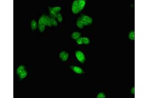 Immunofluorescent analysis of HepG2 cells using ABIN7154802 at dilution of 1:100 and Alexa Fluor 488-congugated AffiniPure Goat Anti-Rabbit IgG(H+L) (NHP2 Antikörper  (AA 1-153))