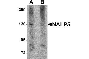 Western Blotting (WB) image for anti-NLR Family, Pyrin Domain Containing 5 (NLRP5) (C-Term) antibody (ABIN1030533)
