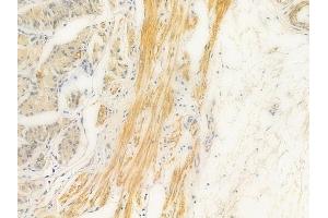 ABIN6261634 and ABIN6269150 at 1/100 staining human normal gastric tissue by IHC-P.