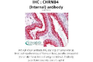 Image no. 1 for anti-Cholinergic Receptor, Nicotinic, beta 4 (Neuronal) (CHRNB4) (Internal Region) antibody (ABIN1733076)