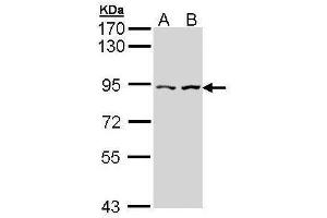 CTNNAL1 Antikörper  (Internal Region)