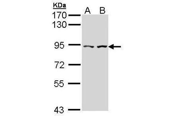 CTNNAL1 Antikörper  (Internal Region)