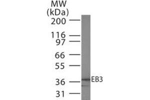 Western Blotting (WB) image for anti-Microtubule-Associated Protein, RP/EB Family, Member 3 (MAPRE3) antibody (ABIN208429)