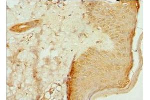 Immunohistochemistry of paraffin-embedded human skin tissue using ABIN7147369 at dilution of 1:100 (ITGB3BP Antikörper  (AA 1-177))