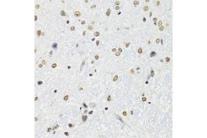 Immunohistochemistry of paraffin-embedded mouse brain using SFPQ antibody (ABIN5970351) at dilution of 1/100 (40x lens).