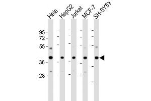 All lanes : Anti-RAE1 Antibody (N-Term) at 1:2000-1:4000 dilution Lane 1: Hela whole cell lysate Lane 2: HepG2 whole cell lysate Lane 3: Jurkat whole cell lysate Lane 4: MCF-7 whole cell lysate Lane 5: SH-SY5Y whole cell lysate Lysates/proteins at 20 μg per lane. (RAE1 Antikörper  (AA 19-42))