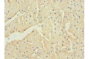 Immunohistochemistry of paraffin-embedded human heart tissue using ABIN7171931 at dilution of 1:100 (TTC32 Antikörper  (AA 1-151))