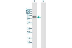 Western Blot analysis of XRCC4 expression in transfected 293T cell line by XRCC4 MaxPab polyclonal antibody. (XRCC4 Antikörper  (AA 1-336))