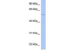 WB Suggested Anti-TRIM58 Antibody Titration: 0. (TRIM58 Antikörper  (Middle Region))
