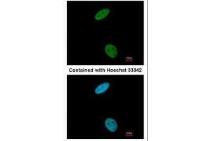 ICC/IF Image Immunofluorescence analysis of paraformaldehyde-fixed HeLa, using CDK6, antibody at 1:200 dilution. (CDK6 Antikörper)