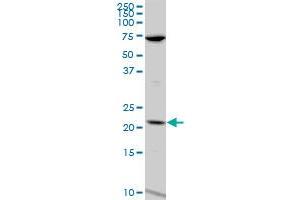 LCN1 polyclonal antibody (A01), Lot # 060814QCS1.