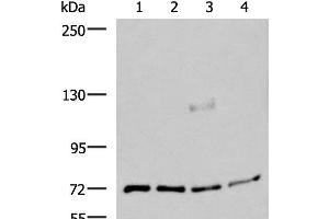 Western blot analysis of A549 A172 TM4 and PC3 cell lysates using ASTE1 Polyclonal Antibody at dilution of 1:600 (ASTE1 Antikörper)