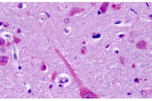 Anti-GPR75 antibody IHC staining of human brain, cortex, neurons.