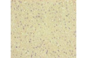 Immunohistochemistry of paraffin-embedded human adrenal gland tissue using ABIN7160738 at dilution of 1:100 (NAA25 Antikörper  (AA 703-972))