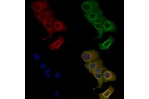 Phospho-ABCA1 (Ser2054) Antibody staining Hela cells(heat shock treatment) by IF/ICC. (ABCA1 Antikörper  (pSer2054))