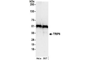 Western Blotting (WB) image for anti-Thyroid Hormone Receptor Interactor 6 (TRIP6) (AA 100-150) antibody (ABIN7449172)