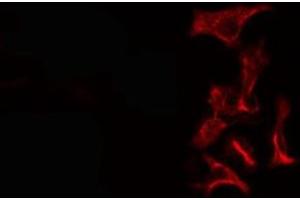 ABIN6276370 staining Hela cells by IF/ICC.