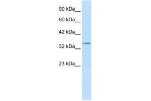 Western Blotting (WB) image for anti-Potassium Voltage-Gated Channel, Shaker-Related Subfamily, beta Member 2 (KCNAB2) (C-Term) antibody (ABIN2776306)