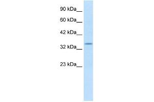 WB Suggested Anti-KCNAB2 Antibody Titration:  1. (KCNAB2 Antikörper  (C-Term))
