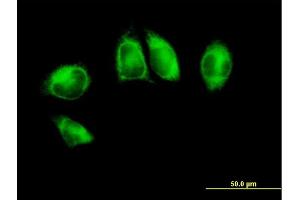 Immunofluorescence of purified MaxPab antibody to POR on HeLa cell. (POR Antikörper  (AA 1-680))