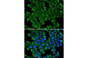 Immunofluorescence analysis of MCF-7 cells using REG3G antibody. (REG3g Antikörper)