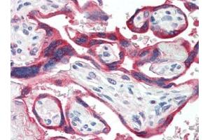 Human Placenta (formalin-fixed, paraffin-embedded) stained with GH1at 10 µg/ml followed by biotinylated goat anti-rabbit IgG secondary antibody, alkaline phosphatase-streptavidin and chromogen. (Growth Hormone 1 Antikörper)