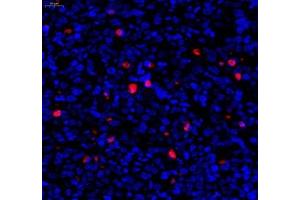 Immunofluorescence (Paraffin-embedded Sections) (IF (p)) image for anti-Caspase 3 (CASP3) (cleaved) antibody (ABIN7073336)