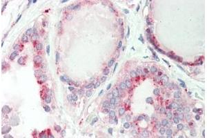 Haman, Thyroid: Foramlin-Fixed Paraffin-Embedded (FFPE) (GATAD1 Antikörper  (C-Term))