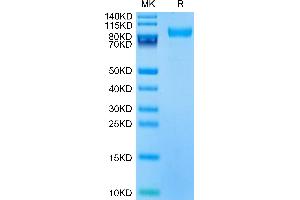 SDS-PAGE (SDS) image for CD180 Molecule (CD180) (AA 21-626) protein (His tag) (ABIN7274092)