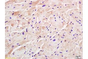 Formalin-fixed and paraffin embedded rat cardiac muscle labeled with Rabbit Anti M Cadherin Polyclonal Antibody, Unconjugated (ABIN719831) at 1:200 followed by conjugation to the secondary antibody and DAB staining (CDH15 Antikörper  (AA 355-450))