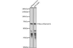 Western blot analysis of extracts of various cell lines, using Neurofilament L antibody (ABIN7268867) at 1:50000 dilution. (NEFL Antikörper)