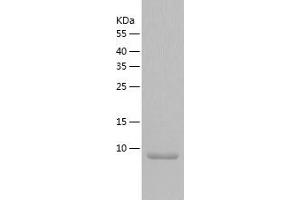 Western Blotting (WB) image for Selenoprotein W, 1 (SEPW1) (AA 1-87) protein (His tag) (ABIN7125018) (Selenoprotein W Protein (AA 1-87) (His tag))