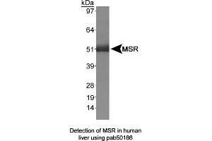 Image no. 1 for anti-Macrophage Scavenger Receptor 1 (MSR1) (AA 300-350) antibody (ABIN363495) (Macrophage Scavenger Receptor 1 Antikörper  (AA 300-350))