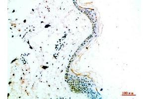 Immunohistochemical analysis of paraffin-embedded human-skin, antibody was diluted at 1:200 (COL14A1 Antikörper  (AA 1571-1620))