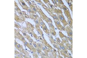Immunohistochemistry of paraffin-embedded human liver using CAD antibody (ABIN5974557) at dilution of 1/100 (40x lens). (CAD Antikörper)