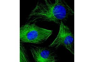 Immunofluorescent analysis of 4 % paraformaldehyde-fixed, 0. (TUBB2A Antikörper  (AA 14-46))