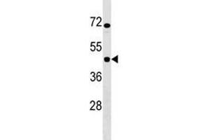 IKBIP antibody western blot analysis in Jurkat lysate. (IKbIP Antikörper  (AA 319-345))