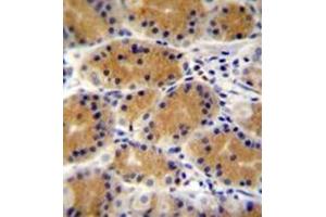 Immunohistochemistry analysis in formalin fixed and paraffin embedded human stomach tissue reacted with PLEKHG3 Antibody (C-term) followed which was peroxidase conjugated to the secondary antibody and followed by DAB staining. (PLEKHG3 Antikörper  (C-Term))
