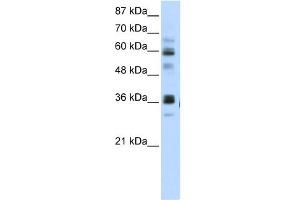 WB Suggested Anti-RPUSD2 Antibody Titration:  5. (RPUSD2 Antikörper  (N-Term))